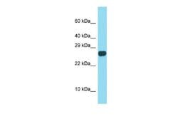 SPACA3 Rabbit anti-Mouse, Polyclonal, Novus Biologicals 0.1ml; Unconjugated:Antibodies,